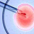 Clinical Pregnancy Rates with IVF: An Overview