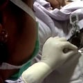 Understanding Embryo Transfer in IVF