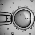 Consent Forms for Egg Donation: A Legal Perspective