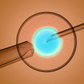 IVF with Donor Sperm: Exploring the Process