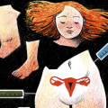 Disadvantages of Assisted Reproductive Technology (ART) over Natural Conception