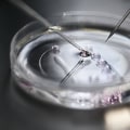 Medical Loans for IVF Treatment: An Overview of Financing Options