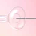 IVF and Ovarian Stimulation: What You Need to Know