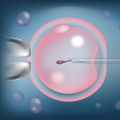 Everything You Need to Know About ICSI in IVF