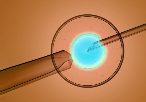 IVF with Donor Sperm: Exploring the Process