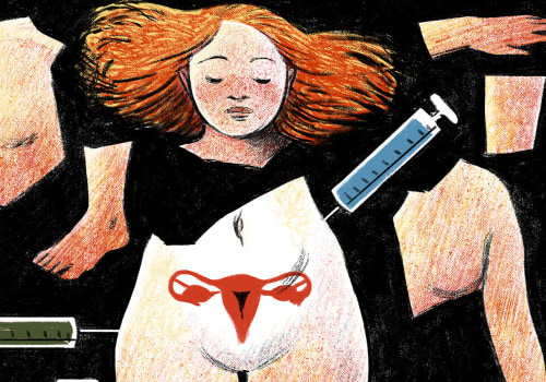 Disadvantages of Assisted Reproductive Technology (ART) over Natural Conception