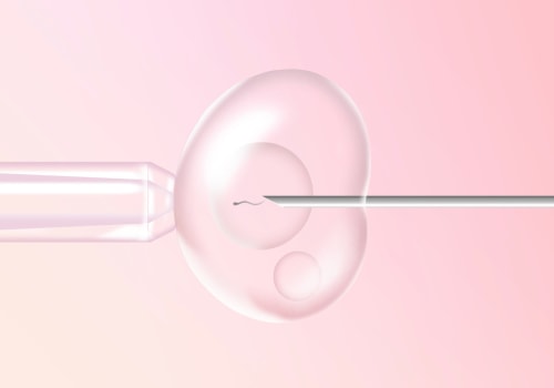 IVF and Ovarian Stimulation: What You Need to Know