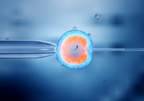 Understanding In-vitro Fertilization (IVF)