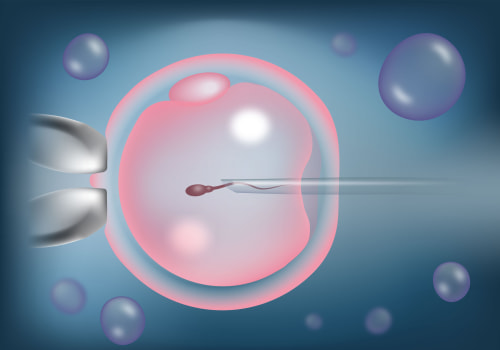 Everything You Need to Know About ICSI in IVF