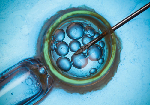 Multiple Births from ART Treatments: A Comprehensive Overview